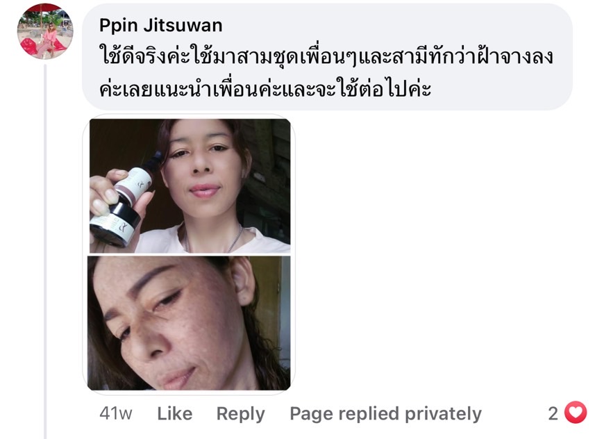 Y8 ดีไหม Y8 ดีจริงไหม รีวิวจากคนใช้จริง ฝ้าหนา ครีม Y8 แก้ฝ้ากระ สิว ผิวติดสาร  