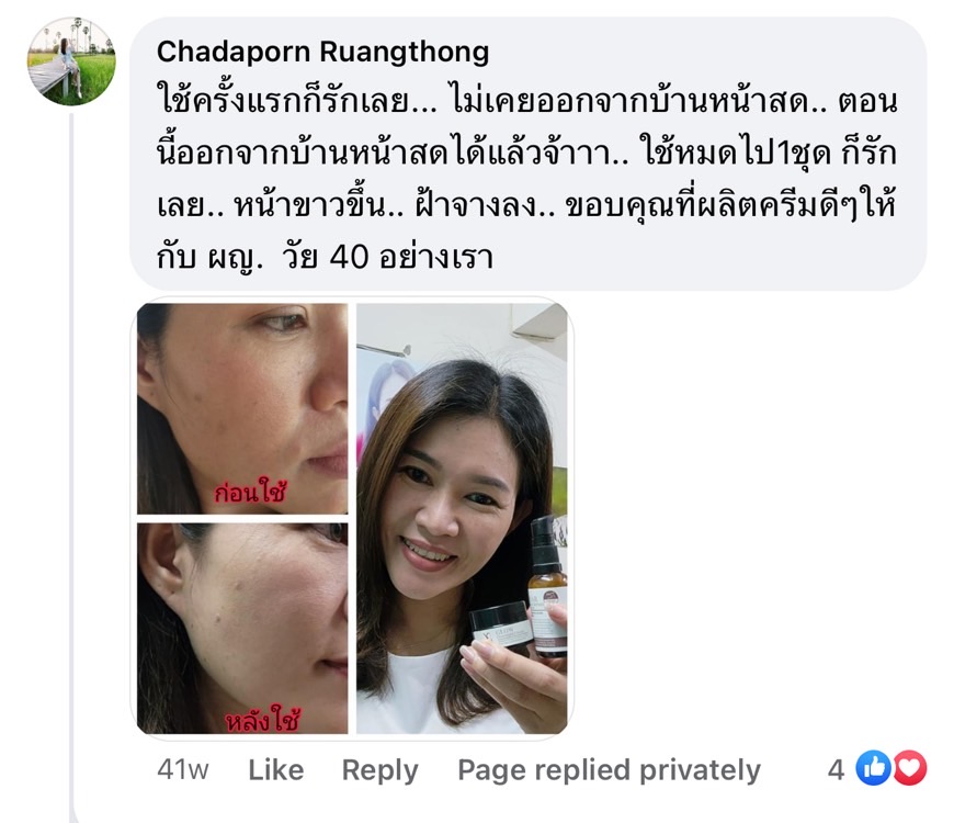 Y8 ดีไหม Y8 ดีจริงไหม รีวิวจากคนใช้จริง ฝ้าหนา ครีม Y8 แก้ฝ้ากระ สิว ผิวติดสาร  