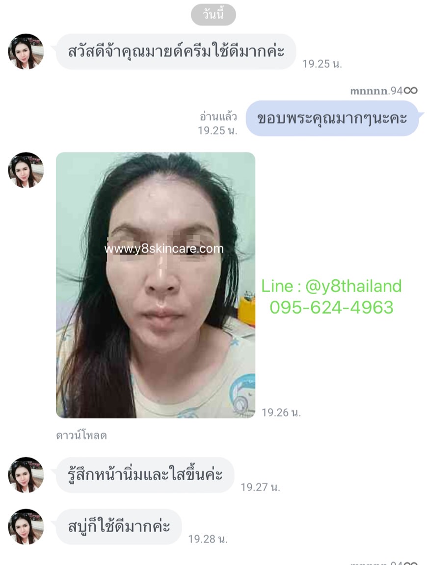 ครีมY8 แก้ฝ้าแดด กันแดดY8 ดีไหม คนเป็นฝ้าใช้แล้ว ดีจริง Y8 ดีจริงไหม ฝ้าแดดสะสม ลองมาเยอะ